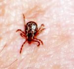 How to protect yourself from ticks this summer