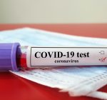 COVID-19 cases drop in Illinois over last week
