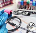 Monkeypox disaster declaration will aid in vaccine distribution